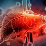 Hepatit C Nedir?